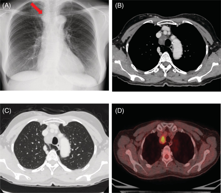 FIGURE 1