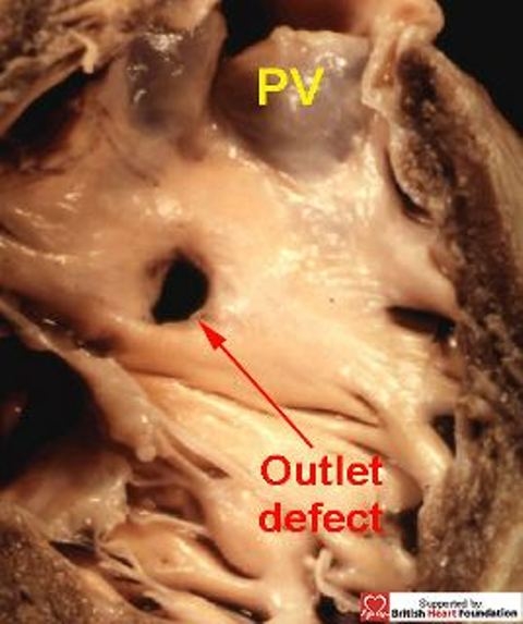 Figure 18