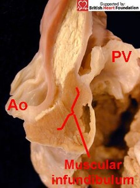 Figure 16