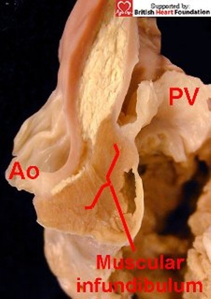 Figure 24