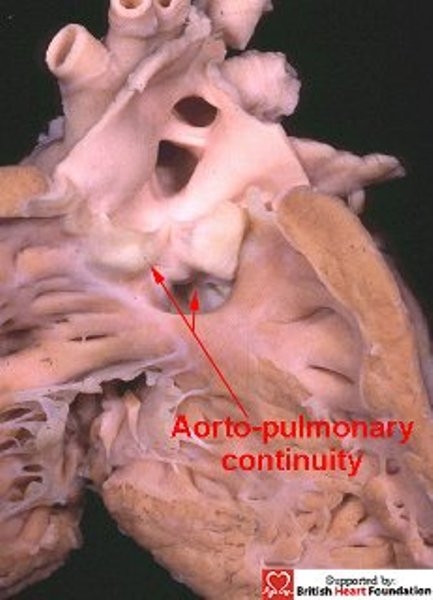 Figure 25