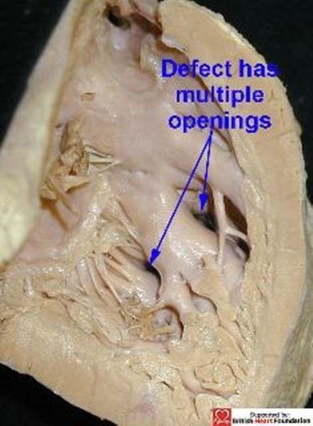 Figure 15