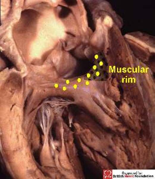 Figure 28