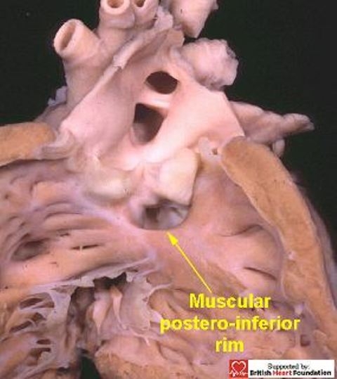 Figure 29