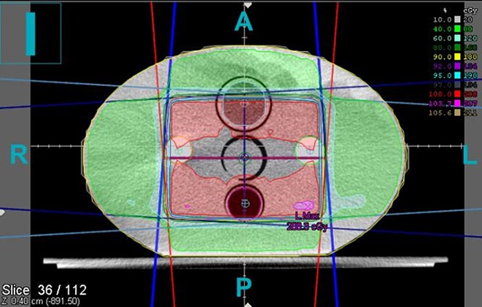 Figure 2