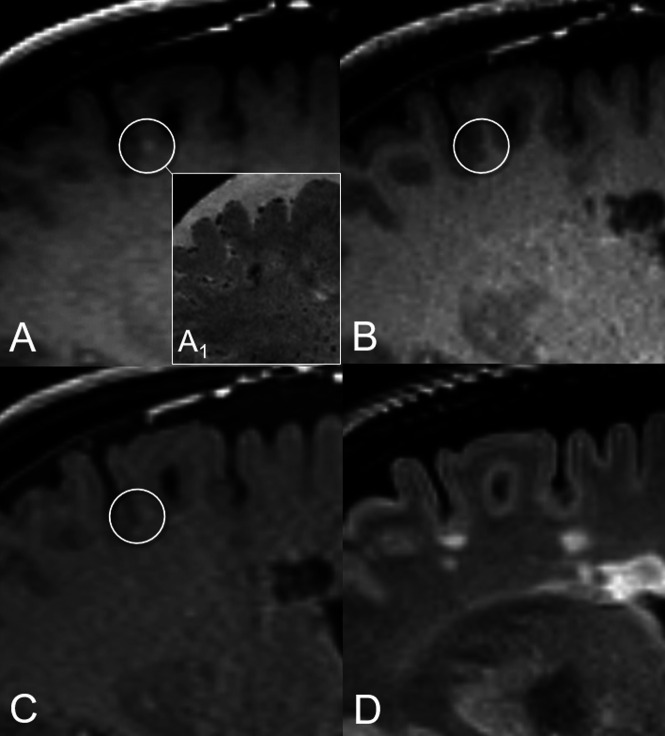 FIG 2.