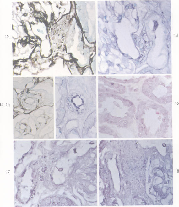 Fig. 12-18