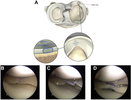 Fig 5