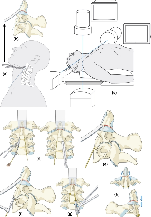 Fig. 4