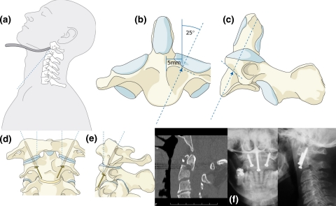 Fig. 5