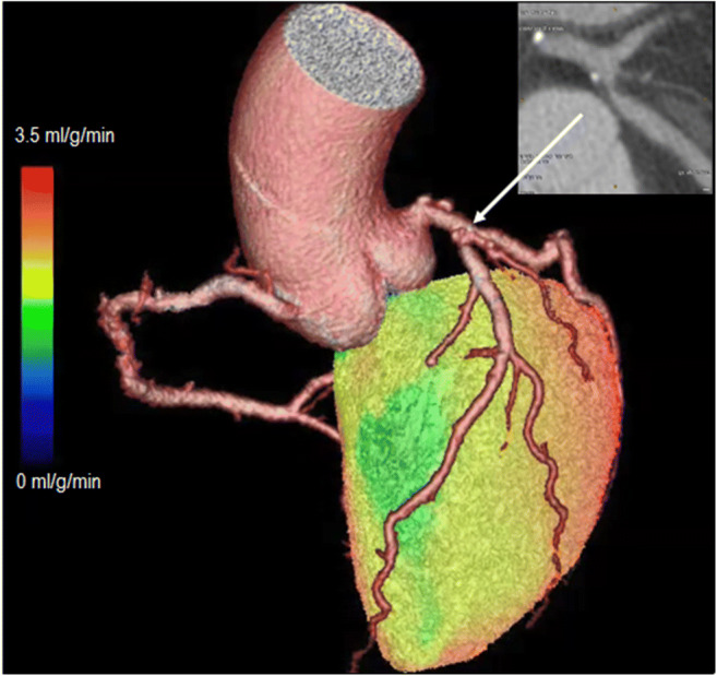 Fig. 9