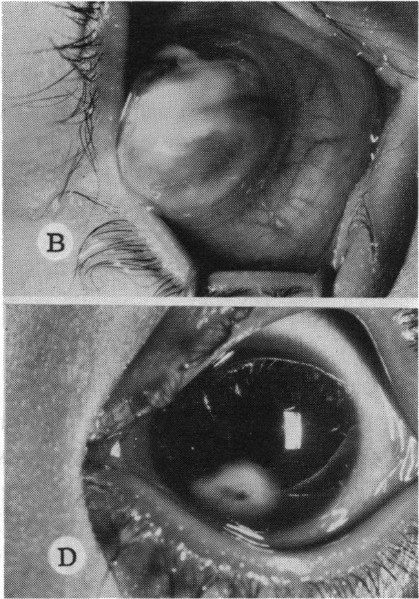 FIGURE 4 B D