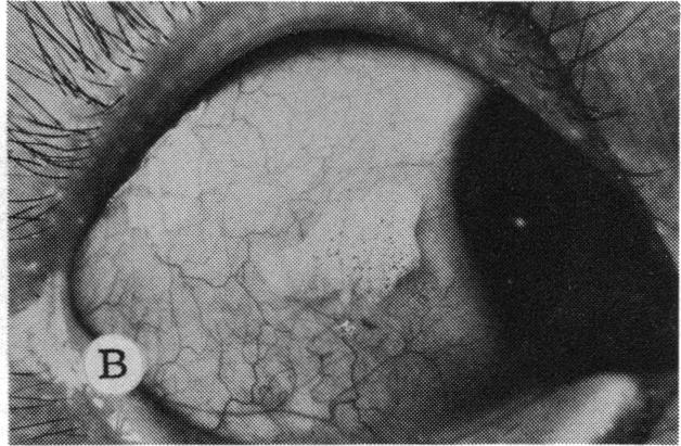 FIGURE 1 B