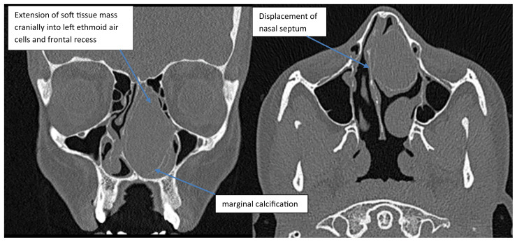 Figure 2a and 2b