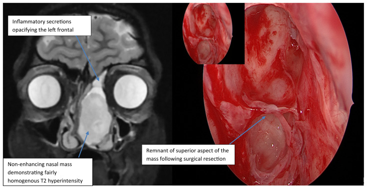 Figure 1a and 1b