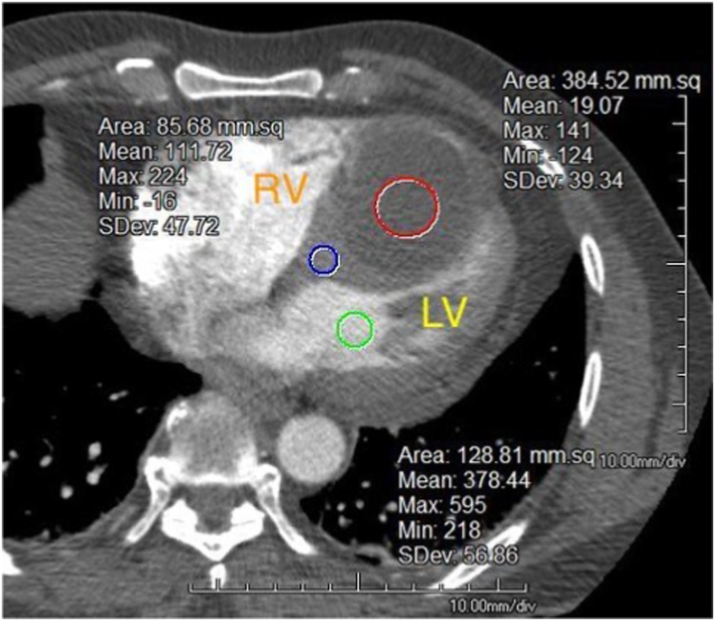 Figure 2