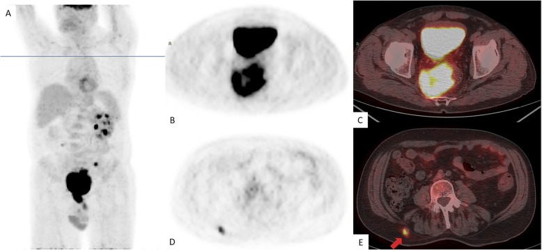 Fig. 4