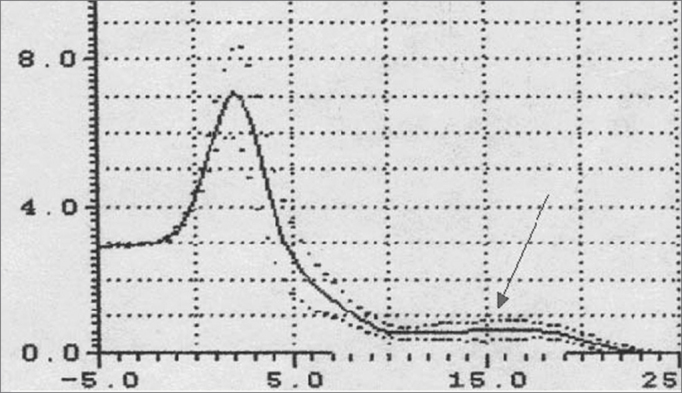 Figure 12