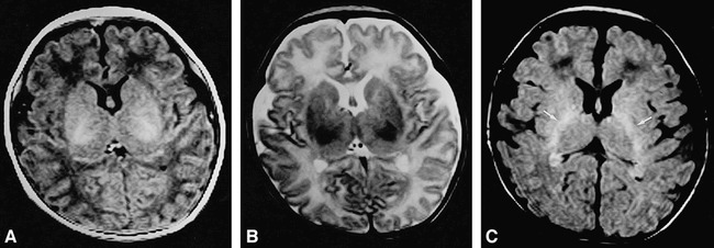 fig 3.