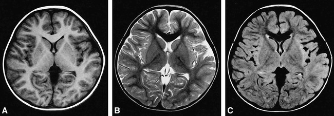 fig 5.