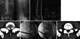 Fig 2