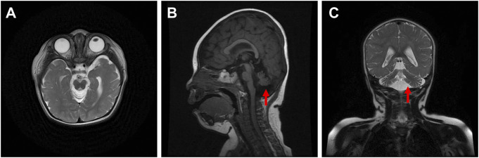 FIGURE 2