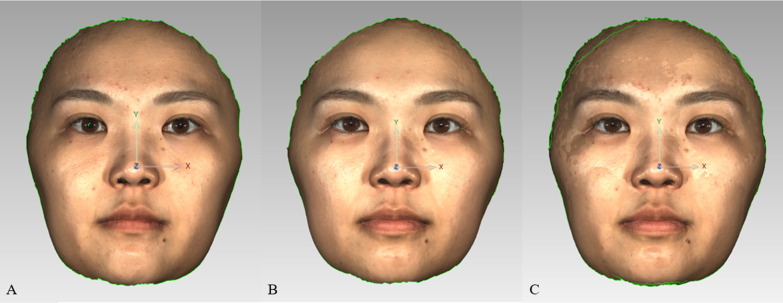 Fig. 2