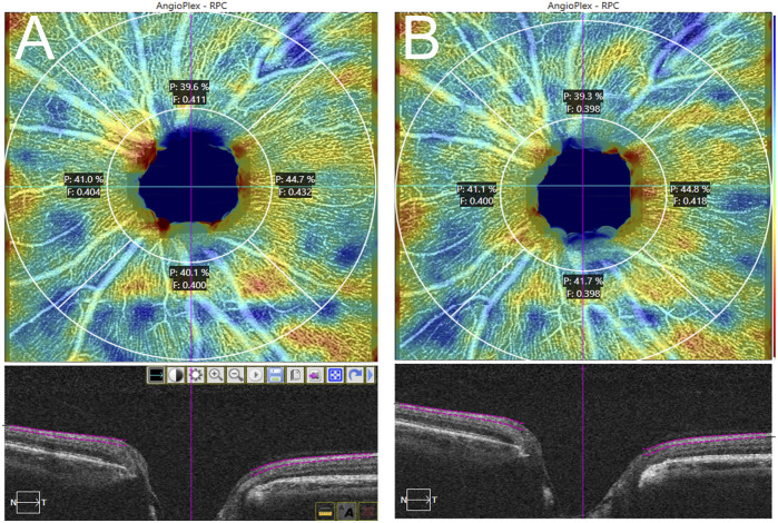 FIGURE 4