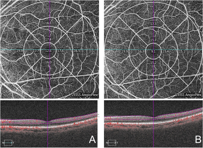 FIGURE 3