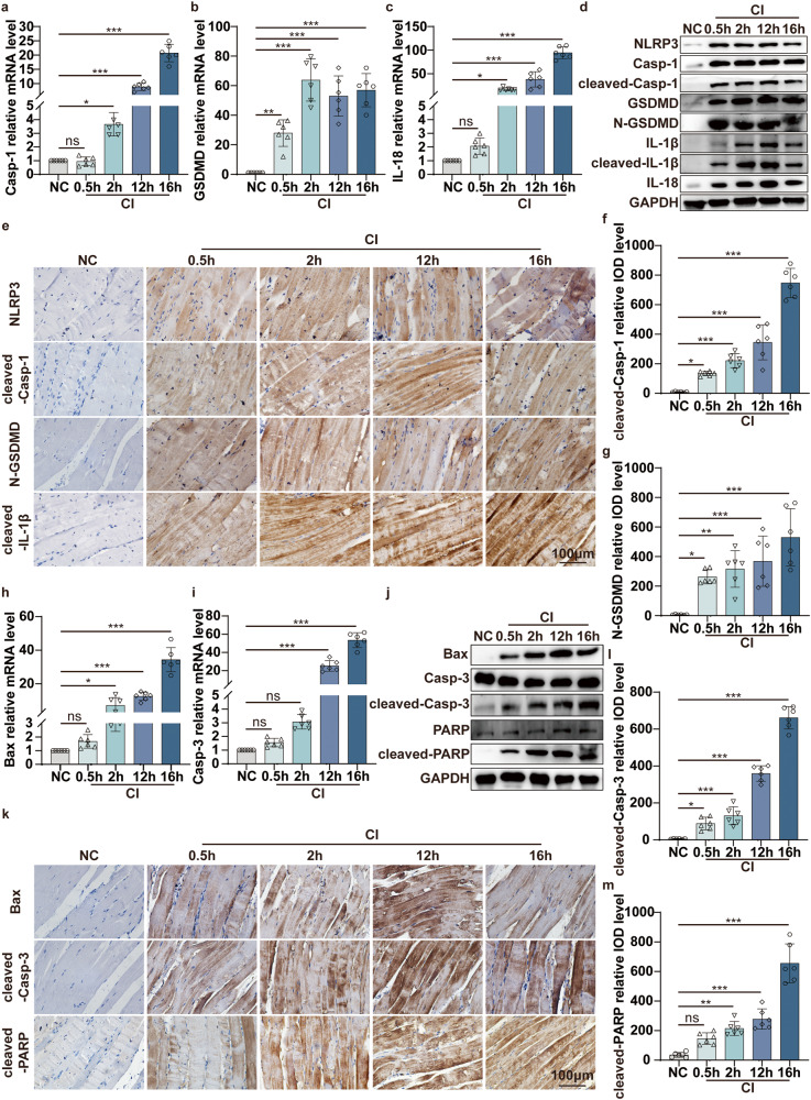 Delayed step-by-step decompression with DSF alleviates skeletal muscle ...