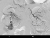 Fig. 12
