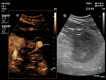 Fig. 11