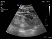 Fig. 13