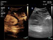 Fig. 14