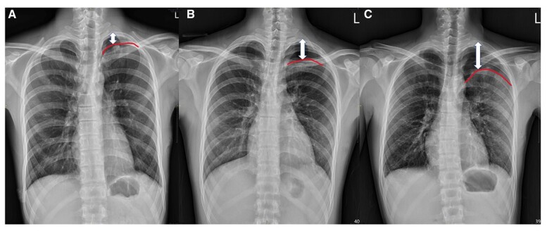 Figure 3: