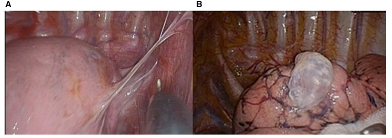 Figure 2: