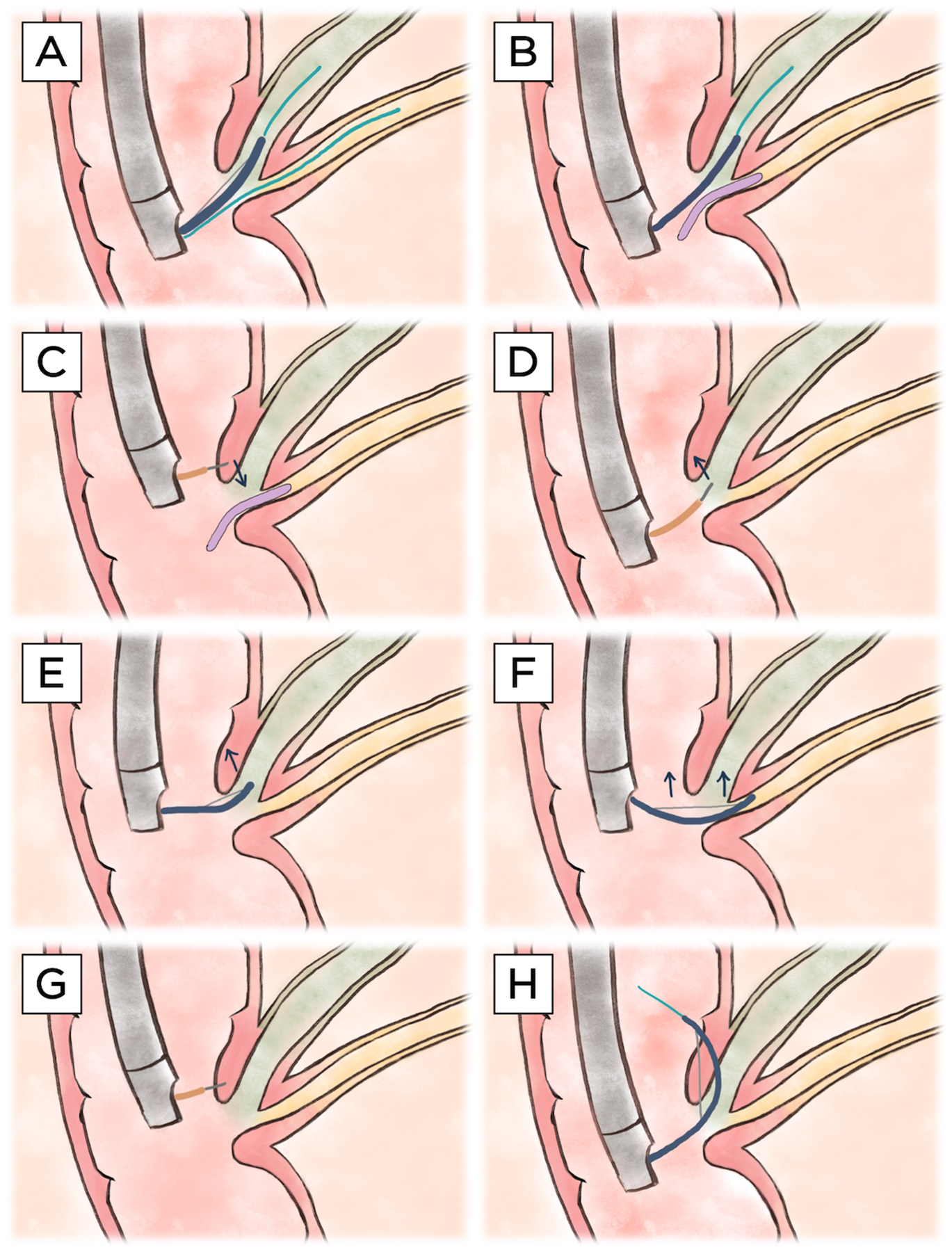 Figure 1: