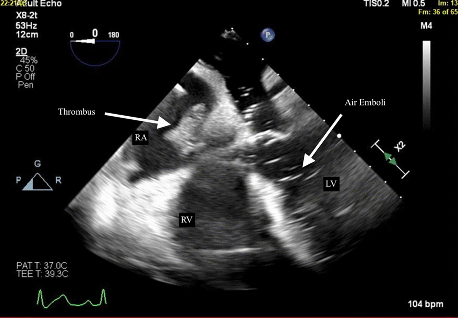 Fig. 1
