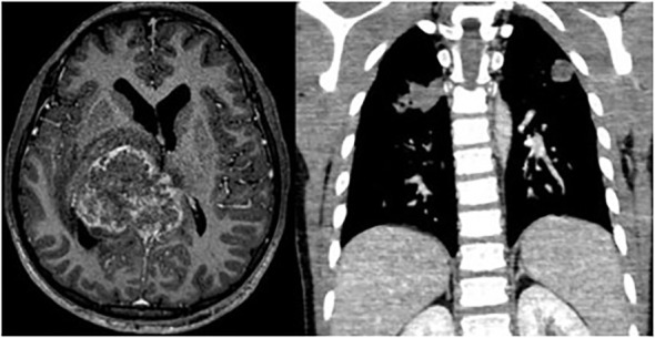 Figure 2