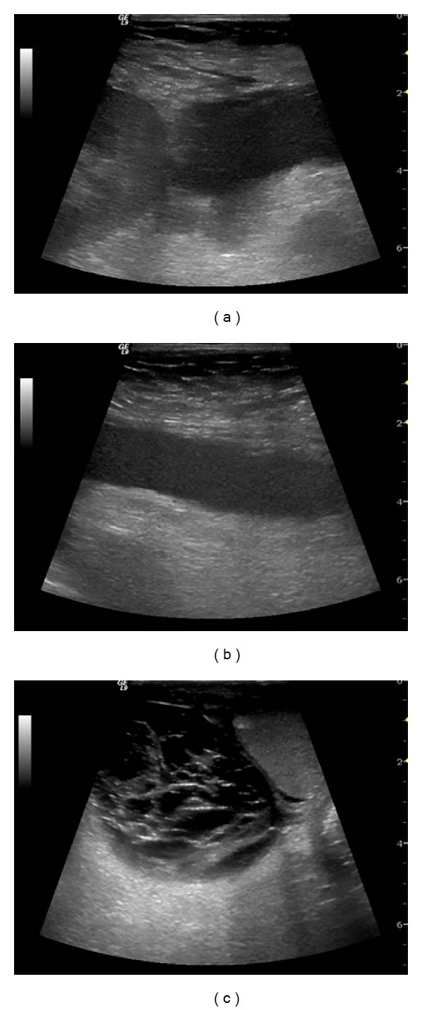 Figure 14