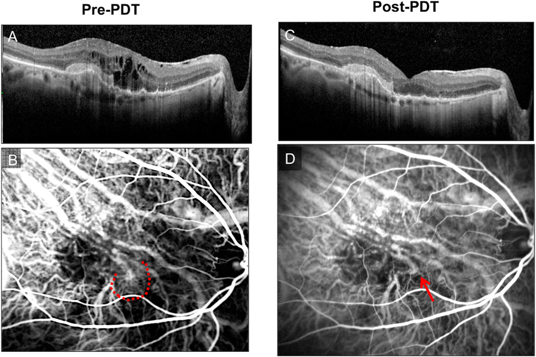 Fig. 22.