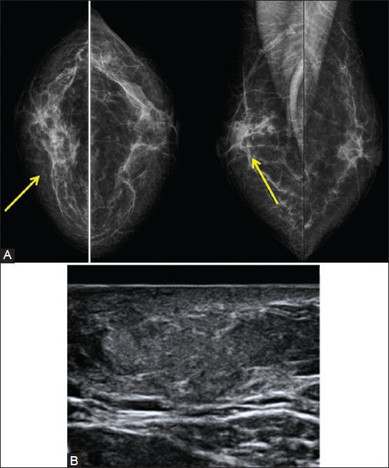 Figure 6 (A, B)