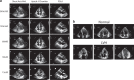 Fig. 11