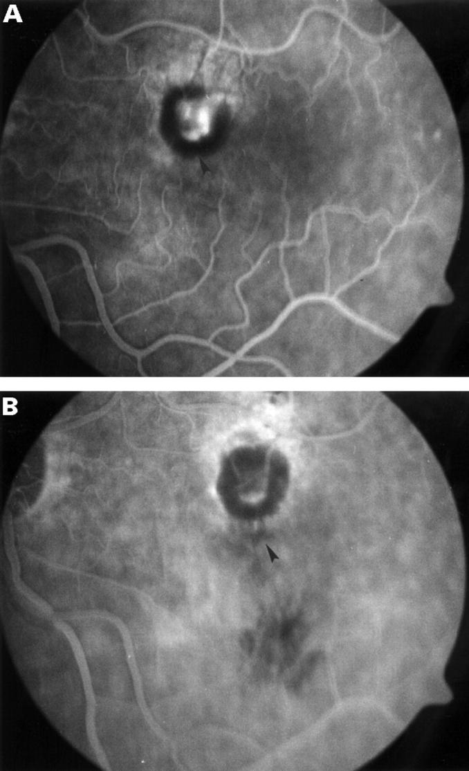 Figure 3  