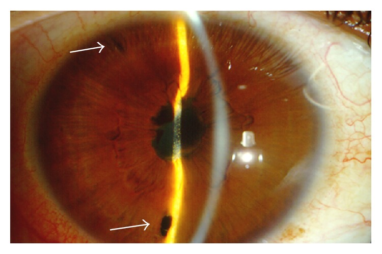 Figure 9