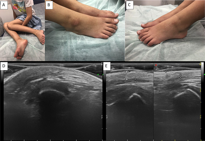 Fig. 2