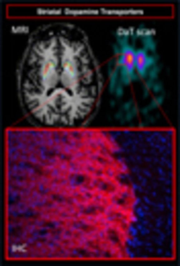 graphic file with name awv063fig1g.jpg