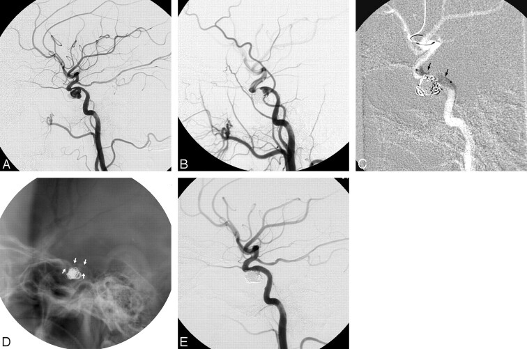 Fig 2.