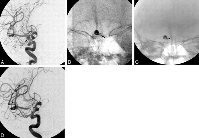 Fig 1.