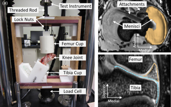 (a) MRI compatible loading frame in the mechanical testing instrument (TA Electro-Force 3510). T1 vibe MRI of knee in (b) axial plane with 3D segmentation of medial meniscus overlayed, and (c) midcoronal plane with outlines of meniscus (gold) and tibial plateau (blue) overlayed. (Color version online.)